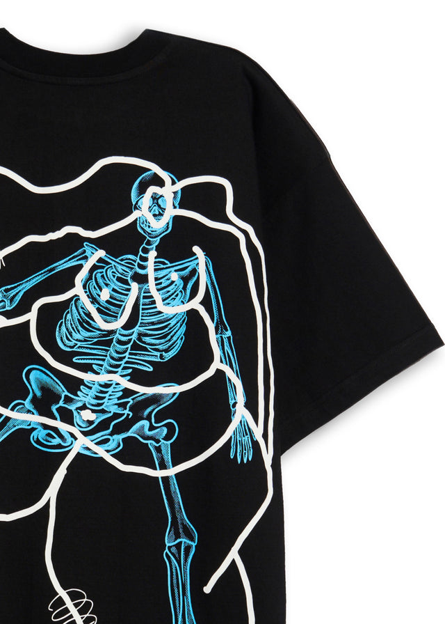 X-RAY LADY T-SHIRT IN BLACK [UNISEX]